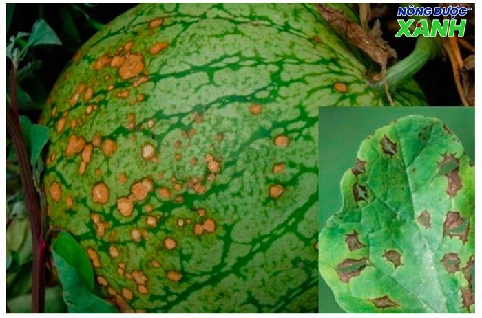 uploads2f20242f072f172f5245890ecd7c54b1eb45c107885473b6a8bea0882fnhung-bien-phap-phong-tru-benh-than-thu nhung-bien-phap-phong-tru-benh-than-thu.jpeg